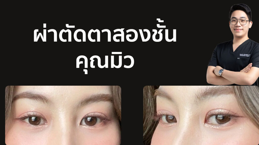 ตาสองชั้น