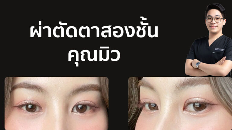 ตาสองชั้น