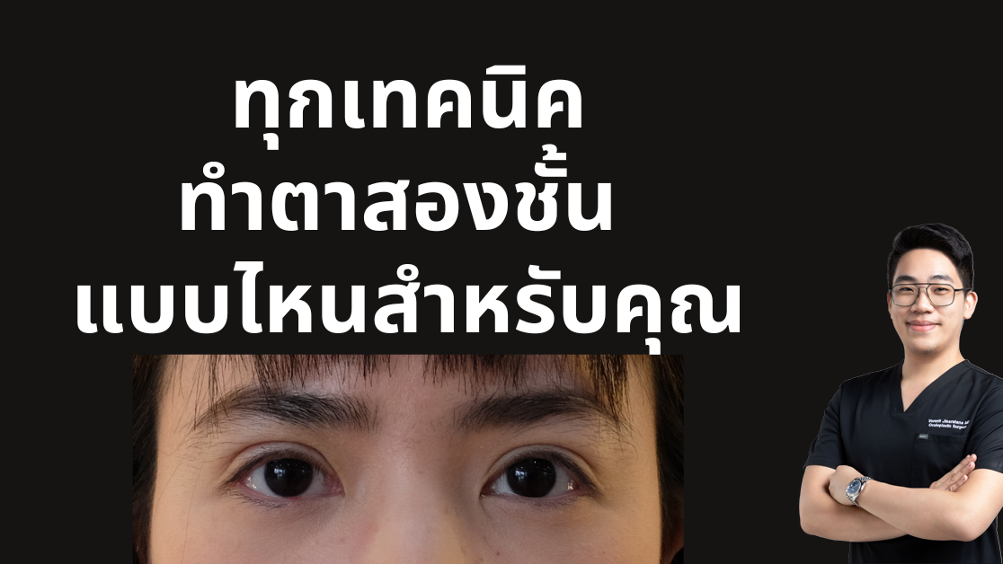 การทำตาสองชั้น